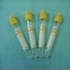 Blood Collection Tube from China (mainland)