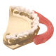 Bridge Implant from China (mainland)