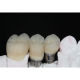 Implant bridge from China (mainland)