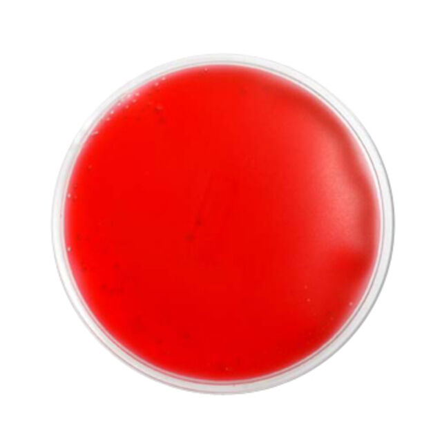 كمادة جل ساخن وبارد رخيصة وقابلة لإعادة الاستخدام للإصابات - كيس جل بارد for sale at factory direct price