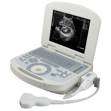 Portable Ultrasound Scanner Ultrasound Machine with Linear Probe