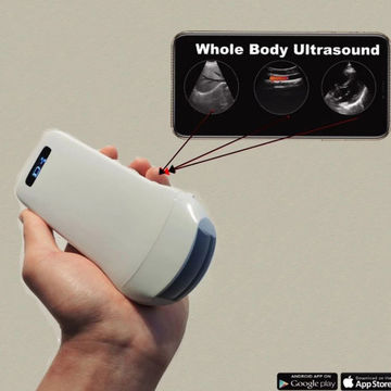 Buy Wholesale China Gen5 3 In 1 Wireless Wifi Ultrasound Probe Iphone ...