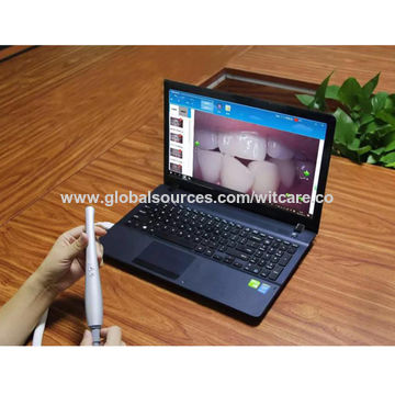 Buy Wholesale China Micro Usb Camera Usb Endoscope Camera & Usb Oral Endoscope at USD 78 | Sources