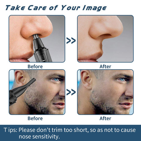 Buy Wholesale China Ear And Nose Hair Trimmer Professional Painless  Electric Eyebrow Facial And Ear Hair Trimmer & Nose Hair Clippers For Men  at USD 3 | Global Sources