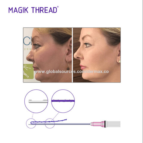 Buy Wholesale China Pdo Thread Procedure Pds Threads Hilos Pdo Nariz ...