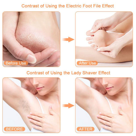 Buy Electric Foot dead skin remover shaver - Best Price in