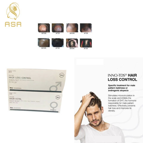 Buy Wholesale China Hair Fall Control Hair Loss Solution Treatments In  Regrowth Thicken Hair Fast At Home For Men & Grow Hair Fast at USD 110 |  Global Sources