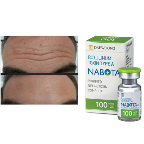 Buy Wholesale China Injectable Wrinkle Removal Btx Botoxs Botulax's ...