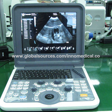 Buy Wholesale China Medical Portable 3d/4d Ob/gyn Ultrasound Machine ...