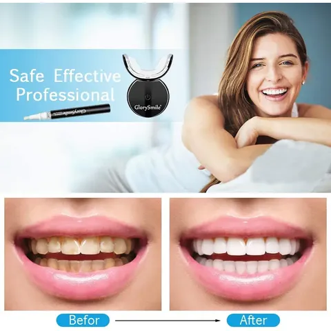35 % de peroxyde d'hydrogène le blanchiment des dents Kit professionnel -  Chine Le blanchiment des dents Kit et le blanchiment des dents prix