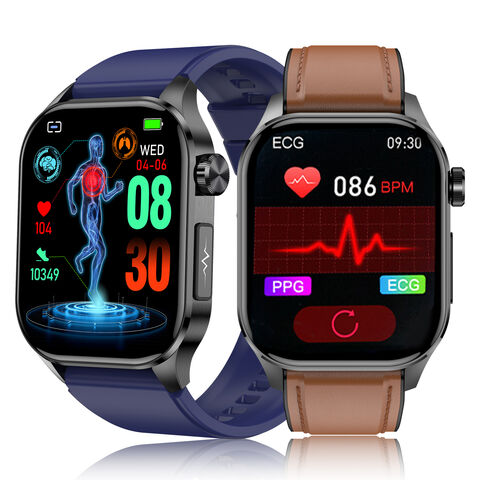 Comparison of the Apple Watch iECG to 12-lead ECG | Download Scientific  Diagram