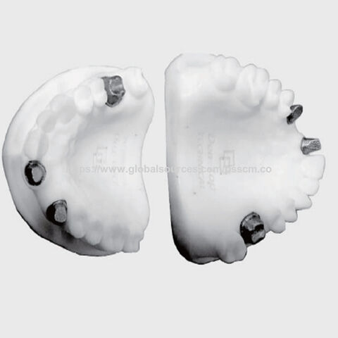 خدمة طباعة ثلاثية الأبعاد و تفريز CNC عالية الدقة لتصنيع دعامات و زرعات معدنية مخصصة for sale at factory direct price