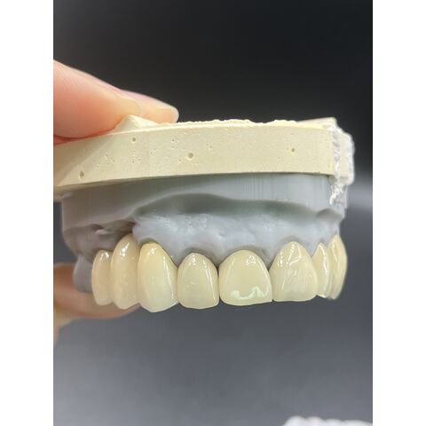 Heißer Verkauf von Zahnveneers, Dentallabor, kundenspezifische Zirkonkronen, Brücken/Implantate, Prothesen für ästhetische Anforderungen.