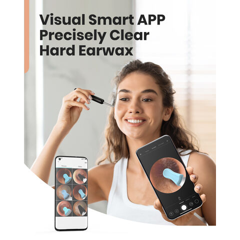 Otoscopio Inalámbrico OEM con Cámara HD, Iluminación LED y Control por APP para Visualización Mejorada del Canal Auditivo