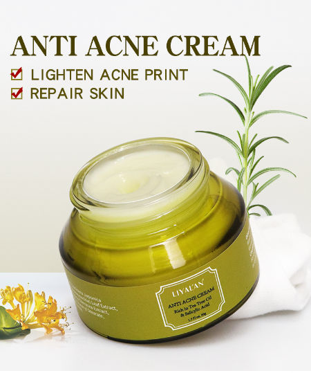 anti acne face cream