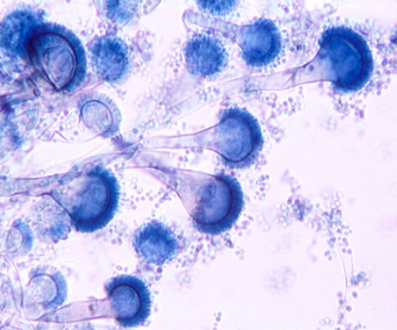 China Aspergillus Galactomanna Detection(Lateral Flow Assay), rapid ...