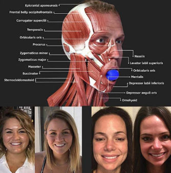 Jaw building online exercises