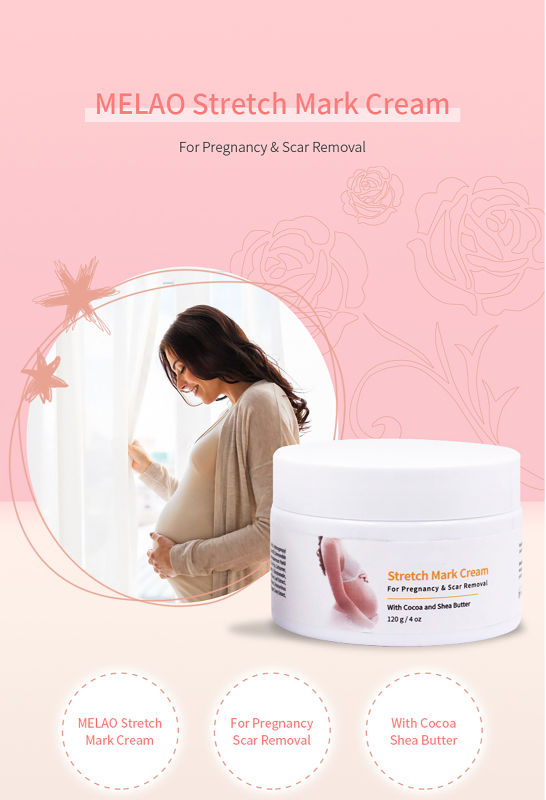 Stretch Marks Removal Cream Stretch Marks Removal Cream For Body - China  Wholesale Stretch Mark Cream $3.64 from Dalian Yuanyang International Trade  Co., Ltd