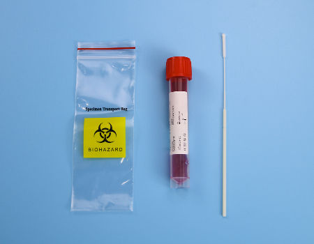 Transport Pcr Examples China Specimen Collection Oral Nasal Swab with Transport Tube on Global ...