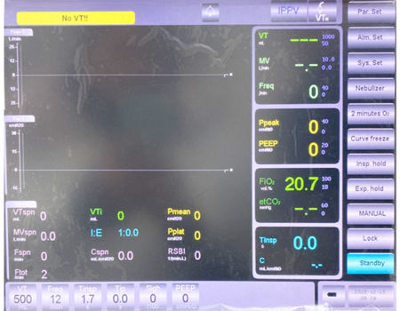 Buy Wholesale China Real Time Icu Ventilator For Adults & Icu ...