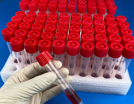 China Tube for Extraction Rna and DNA Sterile Plastic Test Tube for ...