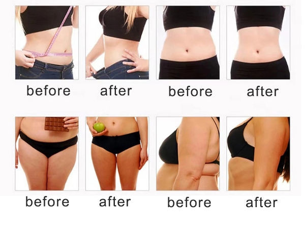 The red fat dissolve fat dissolve injections koren lipo lax fat dissolving supplier