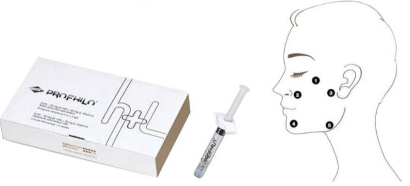 Профайл схемы. Профайло схема введения. Профайло Profhilo препарат. Точки введения профайло шея. Профайло Profhilo 5 точек.