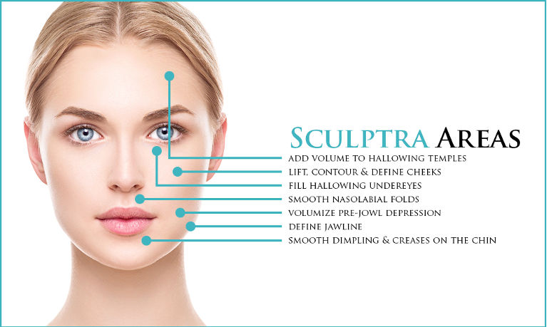Sculptra Plla Poly-L-Lactic Acid Demal Filler Anti-Aging Plastic Facial Surgery Sculptra supplier