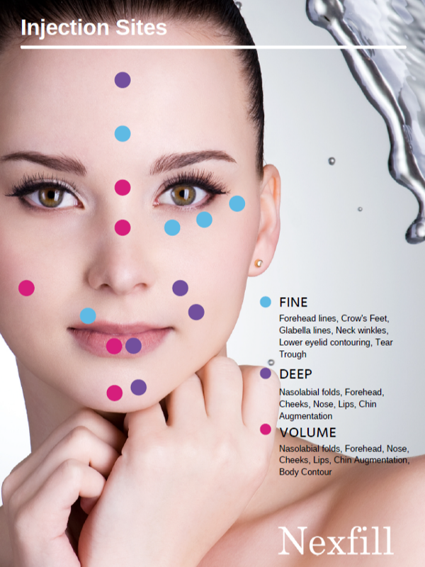 Nexfill- dermal filler Hyaluronic Acid, dermal filler skin care ...