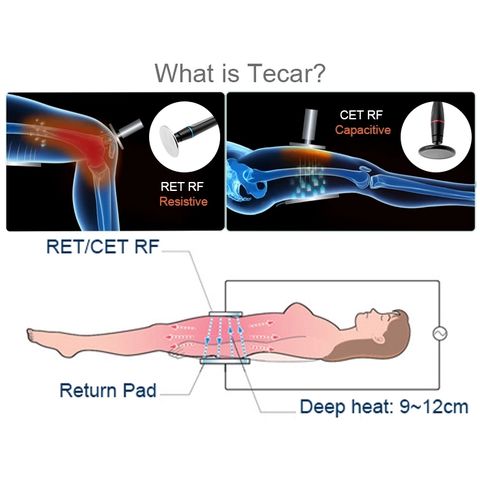 Máquina de diatermia Tecar Terapia RF CET RET para adelgazamiento rápido y reducción de grasa, la más vendida