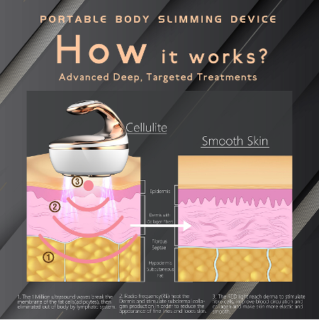 Professional Vauum RF Ultrasound Cavitation Body Slimming Machine Skin Tightening Machine Supplier