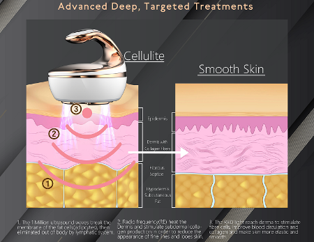 3MHz RF Portable Ultrasonic 40K Cavitation lose weight body massage machine supplier
