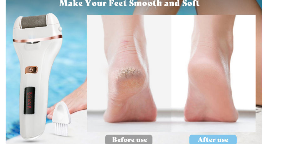 Buy Wholesale China Foot Skin Care Electric Foot Scrubber Dead Skin Remover  Foot Callus Remover & Foot Callus Remover at USD 7.1