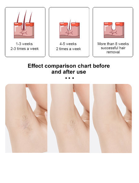 2022 New Products Home Use IPL Laser Hair Removal Device Portable Permanent Supplier