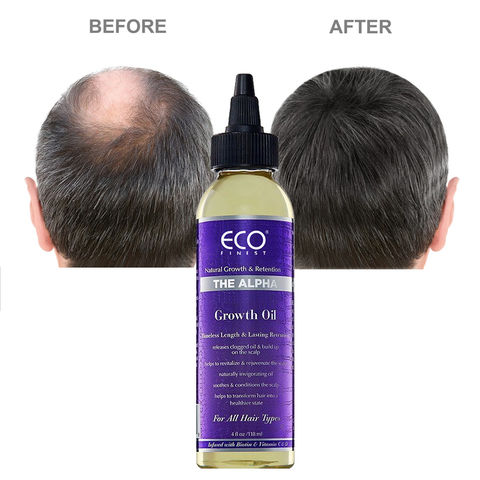 soins capillaires croître le gingembre germinal huile croissance des  cheveux huile essentielle perte de cheveux traitement pour hommes femmes  30ml