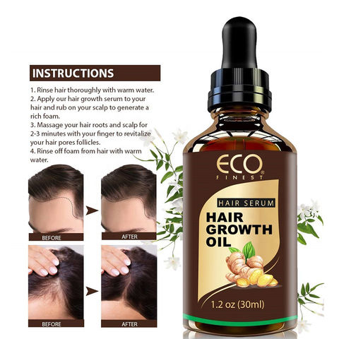 La croissance des cheveux de l'huile de gingembre de gros de la croissance  des cheveux Huile de traitement de réparation - Chine Huile essentielle de  gingembre et la croissance des cheveux prix