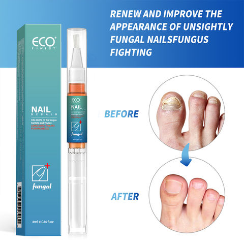 Fungal Nail Treatment, Effective Nail Repair Pen For Fungal And Affected  Nails For Toenails Cuticle Oil Pens for Nail Care with Tea Tree Essential  Oil Fingernails Repair Extra Strong 3ml*4Pen : Amazon.co.uk: