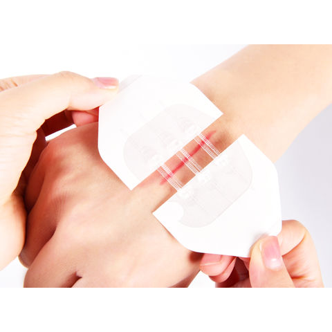 Finger Cut Use Band Aid Wound Plaster for Personal Care - China Band Aid,  Wound Plaster