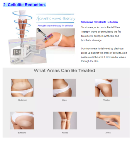 https://p.globalsources.com/IMAGES/PDT/B5387414273/shockwave-therapy-machine.png