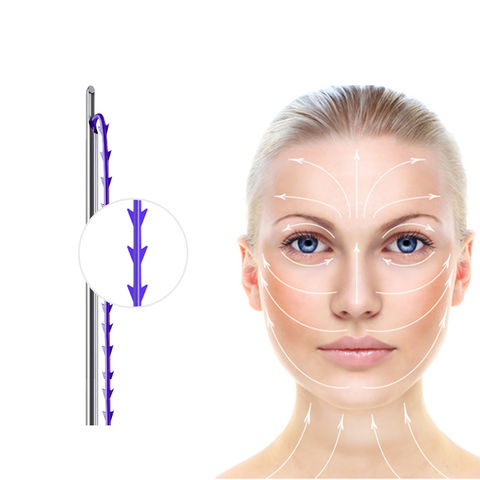 Understanding PDO Thread Lift Diagram