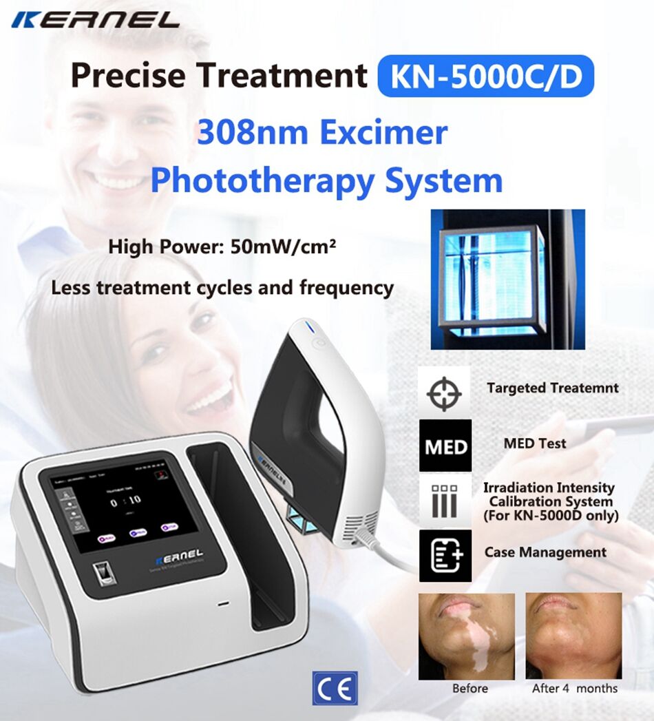 Buy Standard Quality China Wholesale Kn 5000c High Power 308nm Excimer Laser For Trageted