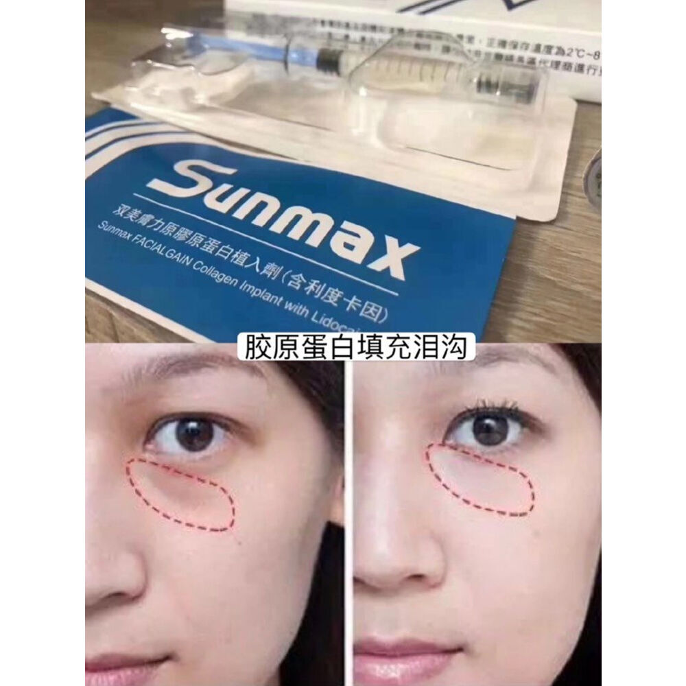 Buy Wholesale China Factory Prices Anti Wrinkle Botulax's Meditoxin ...