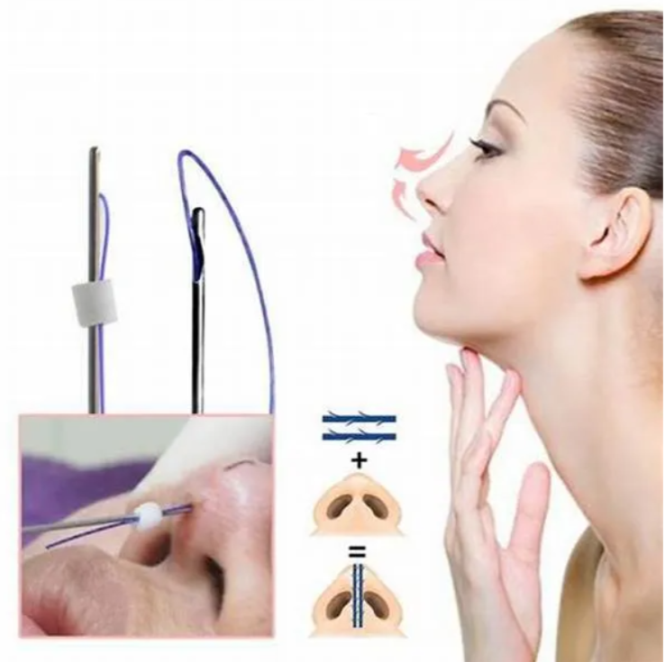 Buy Wholesale China Sterile Absorbable Lift Thread Body Tightening ...