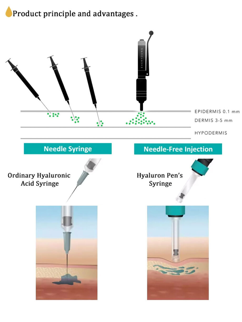 Buy Wholesale China Cross-linked Filler For Ha Pen Free Needles ...