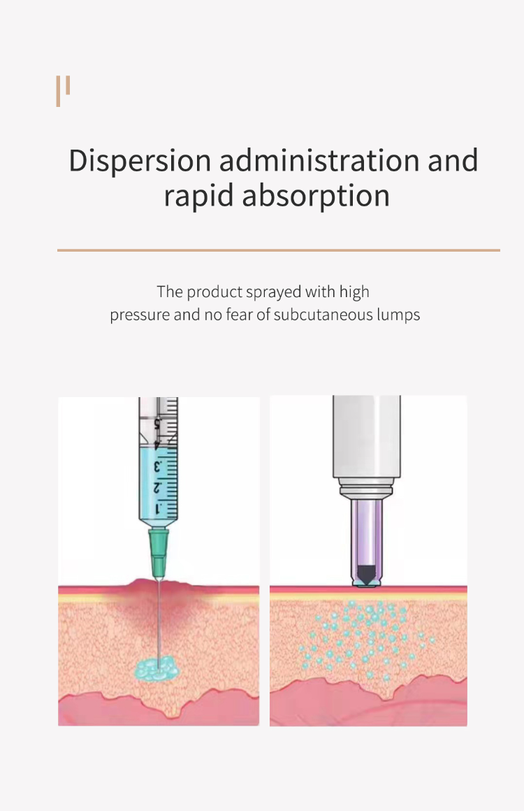 Buy Wholesale China Needleless Insulin Syringe & Sterile Insulin Syringe at USD 50 Global Sources
