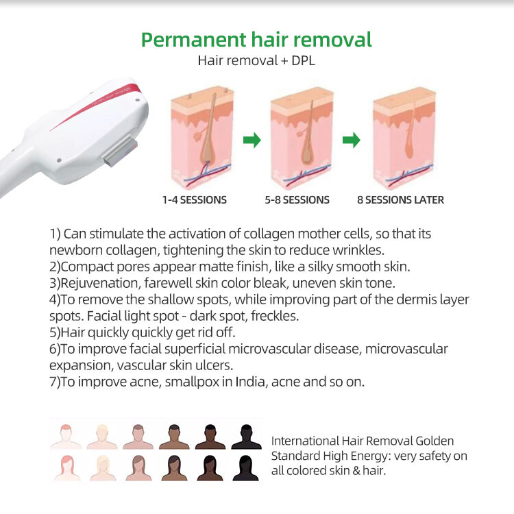 Buy Wholesale China Bowket Dpl Machine For Permanent Hair Remove,acne ...