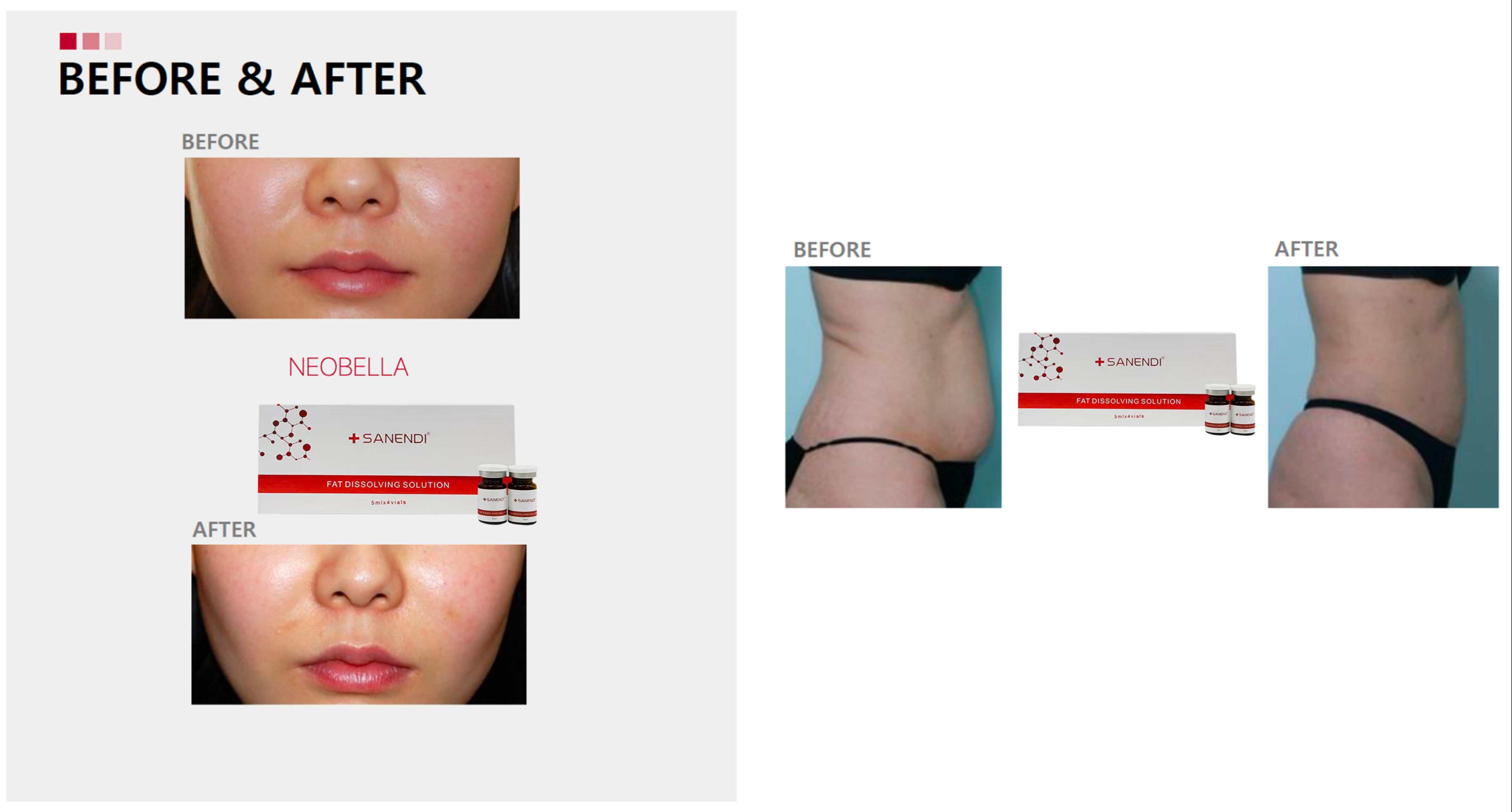 Buy Wholesale China Wholesales The Redfat Dissolving Body Fat Solution ...