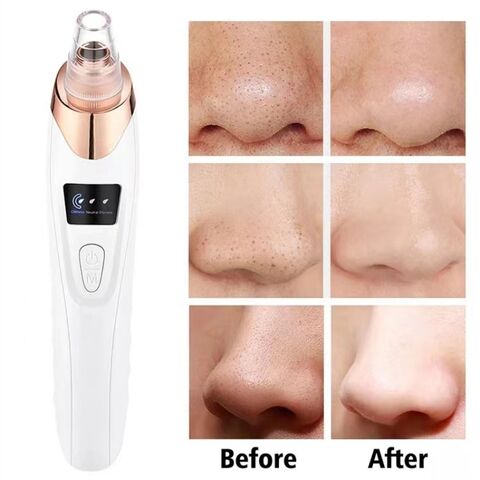 Newest Visual Electric Facial Cleaner Acne Removal Blackhead Absorber Vacuum Suction Blackheads Remover
