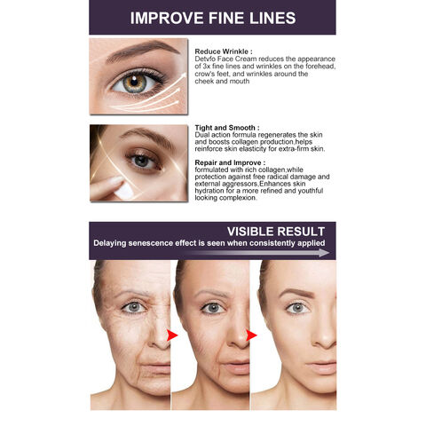 Buy Wholesale China Free Samples 10 Second Wrinkle Remove