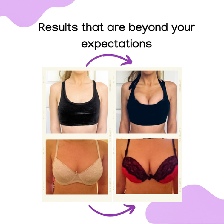 Buy Standard Quality China Wholesale  Best Selling Enlargement Butt  Breast Up A To D Cup Big Capsule Breast Enlargement Pills $2.49 Direct from  Factory at Guangzhou Hollycon Biotechnology Co., Ltd.